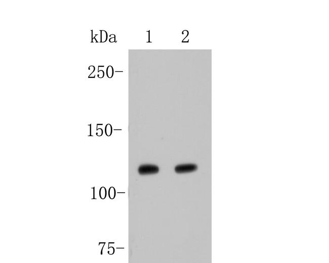 JAK2 Antibody in Western Blot (WB)