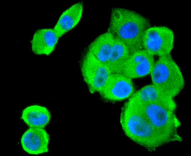 SMAD1 Antibody in Immunocytochemistry (ICC/IF)