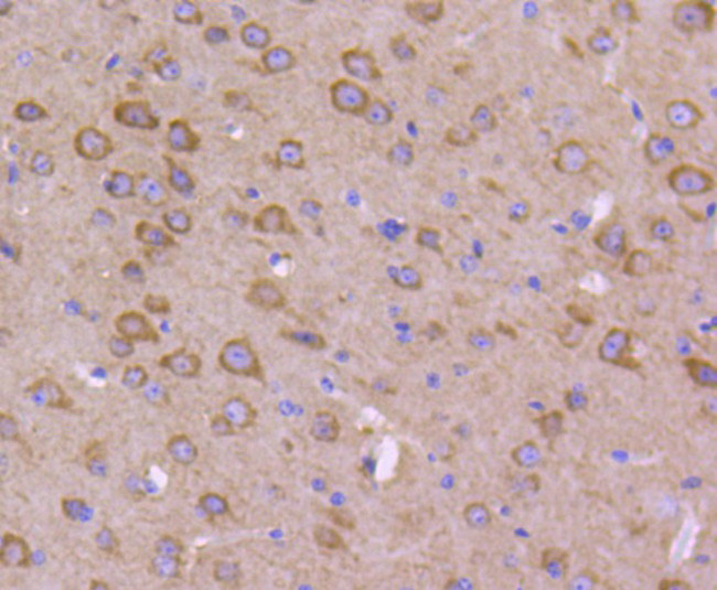 Phospho-GSK3 alpha/beta (Tyr216, Tyr279) Antibody in Immunohistochemistry (Paraffin) (IHC (P))