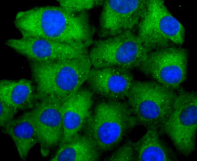 ASK1 Antibody in Immunocytochemistry (ICC/IF)