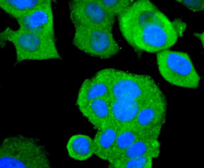 ASK1 Antibody in Immunocytochemistry (ICC/IF)