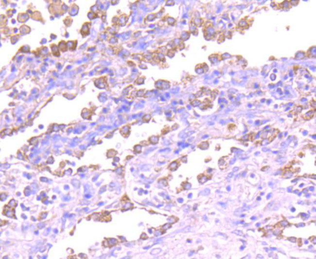 ASK1 Antibody in Immunohistochemistry (Paraffin) (IHC (P))