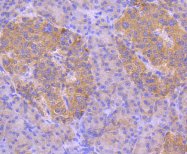 ASK1 Antibody in Immunohistochemistry (Paraffin) (IHC (P))