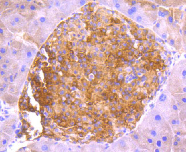 ASK1 Antibody in Immunohistochemistry (Paraffin) (IHC (P))