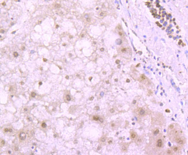 H4K20me3 Antibody in Immunohistochemistry (Paraffin) (IHC (P))