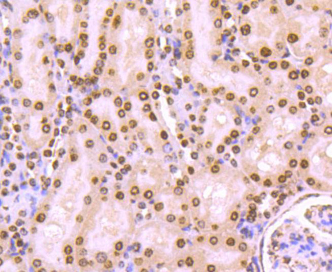 H4K20me3 Antibody in Immunohistochemistry (Paraffin) (IHC (P))