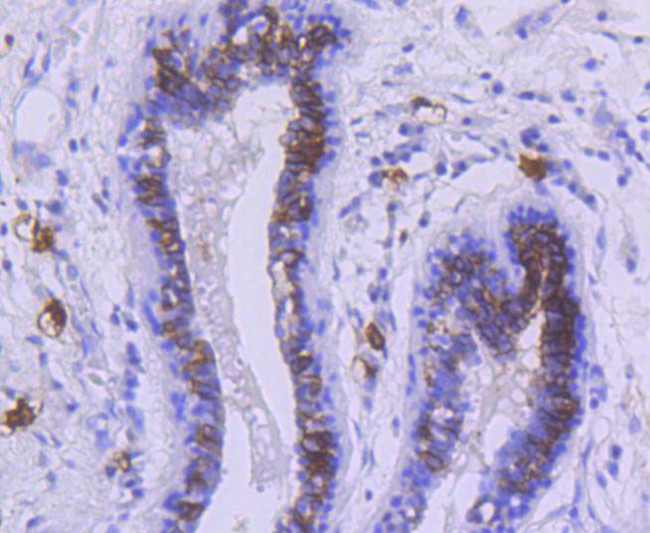 CD117 (c-Kit) Antibody in Immunohistochemistry (Paraffin) (IHC (P))