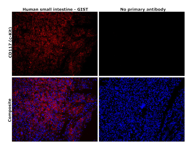 CD117 (c-Kit) Antibody in Immunohistochemistry (Paraffin) (IHC (P))