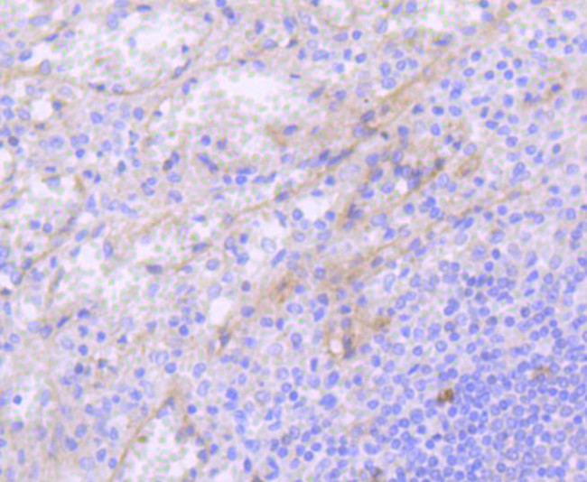 CD117 (c-Kit) Antibody in Immunohistochemistry (Paraffin) (IHC (P))