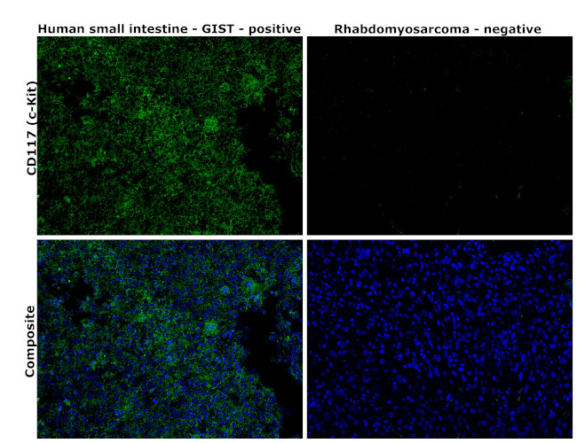 CD117 (c-Kit) Antibody in Immunohistochemistry (Paraffin) (IHC (P))