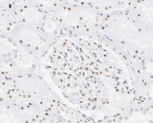 H3R2me1 Antibody in Immunohistochemistry (Paraffin) (IHC (P))