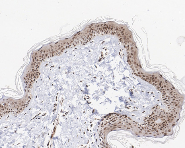 H3R2me1 Antibody in Immunohistochemistry (Paraffin) (IHC (P))