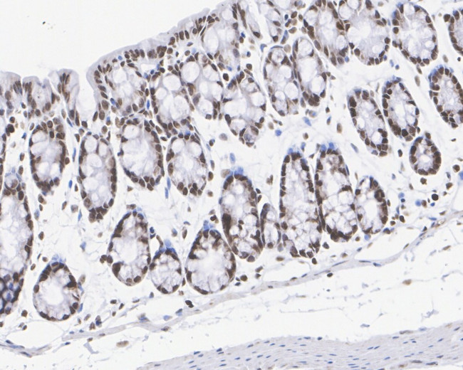 H3R2me1 Antibody in Immunohistochemistry (Paraffin) (IHC (P))