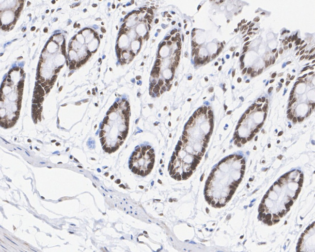 H3R2me1 Antibody in Immunohistochemistry (Paraffin) (IHC (P))