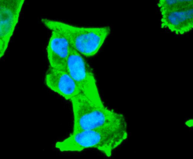 S100B Antibody in Immunocytochemistry (ICC/IF)