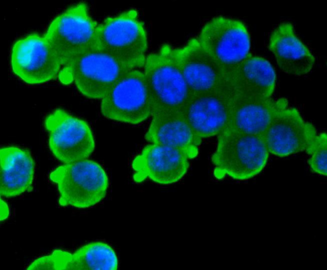 S100B Antibody in Immunocytochemistry (ICC/IF)