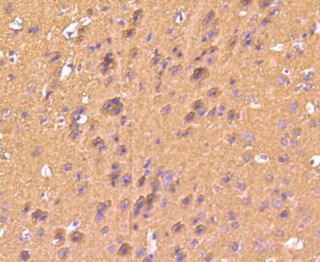 S100B Antibody in Immunohistochemistry (Paraffin) (IHC (P))