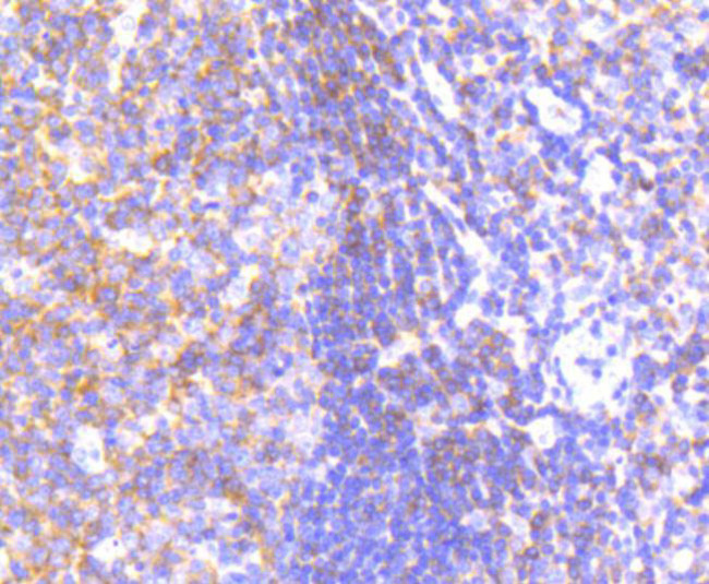 PYK2 Antibody in Immunohistochemistry (Paraffin) (IHC (P))