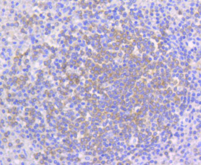 PYK2 Antibody in Immunohistochemistry (Paraffin) (IHC (P))