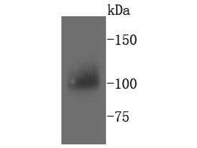 PYK2 Antibody in Western Blot (WB)