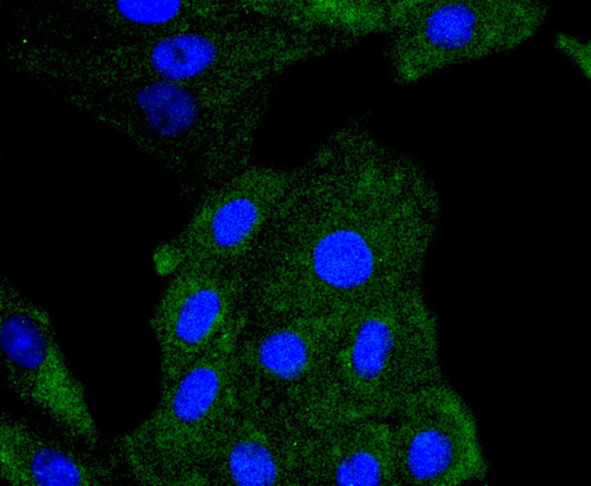 Phospho-PDGFRB (Tyr740) Antibody in Immunocytochemistry (ICC/IF)