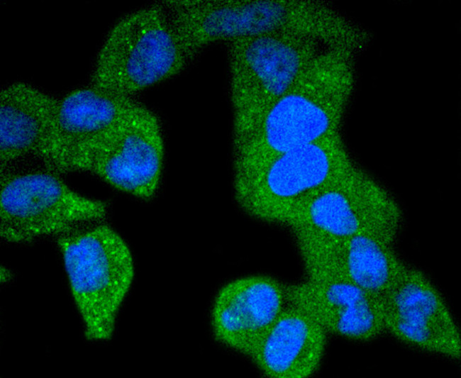 Phospho-PDGFRB (Tyr740) Antibody in Immunocytochemistry (ICC/IF)