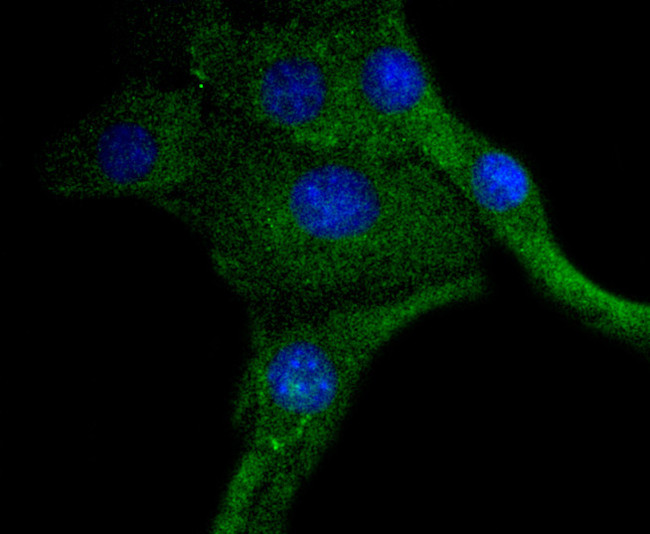 Phospho-PDGFRB (Tyr740) Antibody in Immunocytochemistry (ICC/IF)