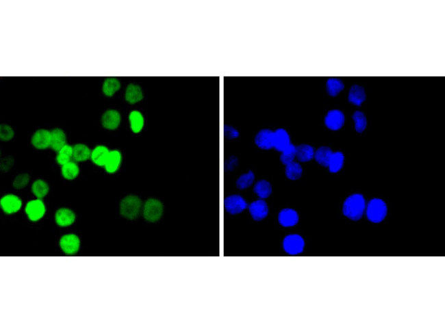 H2BK20ac Antibody in Immunocytochemistry (ICC/IF)