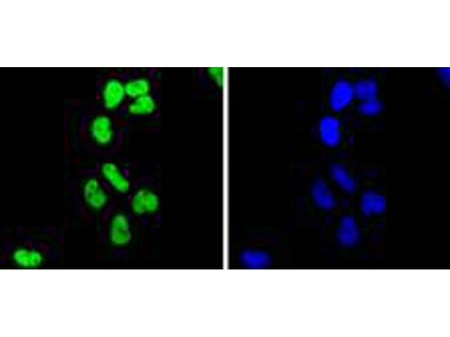 H2BK20ac Antibody in Immunocytochemistry (ICC/IF)