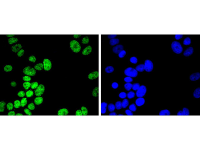 H2BK20ac Antibody in Immunocytochemistry (ICC/IF)