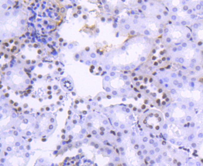 H2BK20ac Antibody in Immunohistochemistry (Paraffin) (IHC (P))