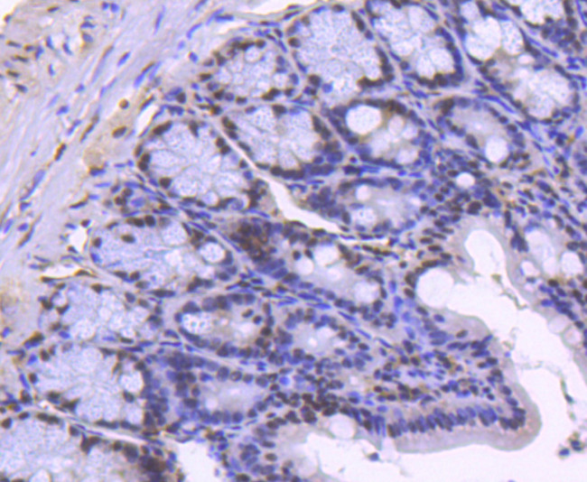 H2BK20ac Antibody in Immunohistochemistry (Paraffin) (IHC (P))