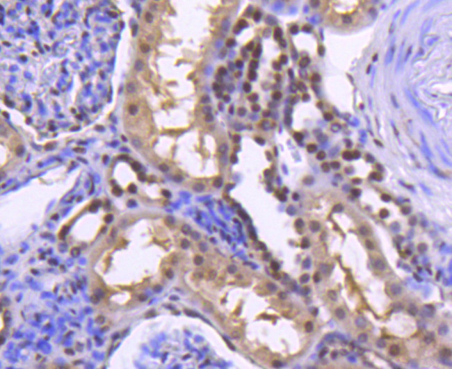 H2BK20ac Antibody in Immunohistochemistry (Paraffin) (IHC (P))