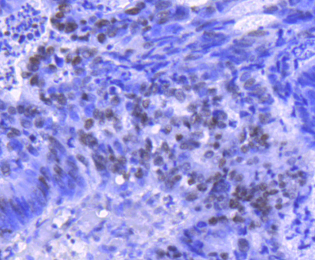 H2BK20ac Antibody in Immunohistochemistry (Paraffin) (IHC (P))