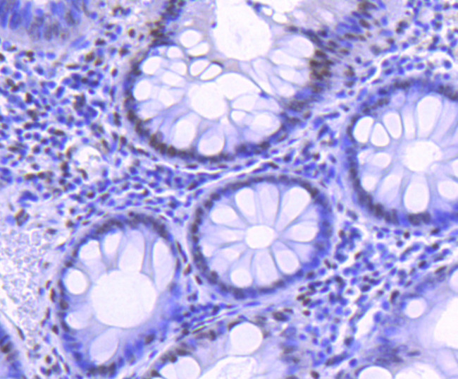 H2BK20ac Antibody in Immunohistochemistry (Paraffin) (IHC (P))