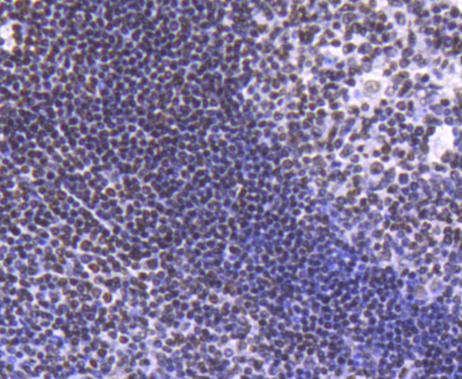 H2BK20ac Antibody in Immunohistochemistry (Paraffin) (IHC (P))