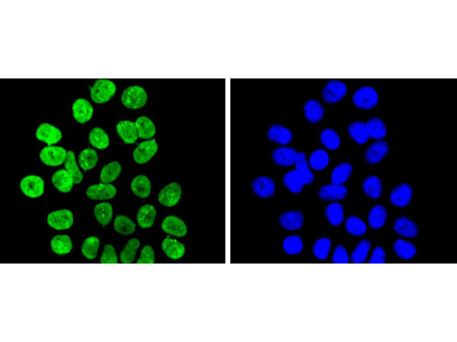 H3K9me2 Antibody in Immunocytochemistry (ICC/IF)