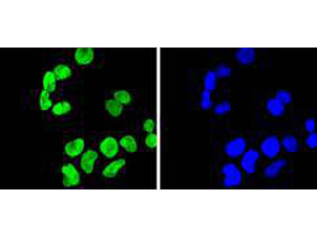 H3K9me2 Antibody in Immunocytochemistry (ICC/IF)