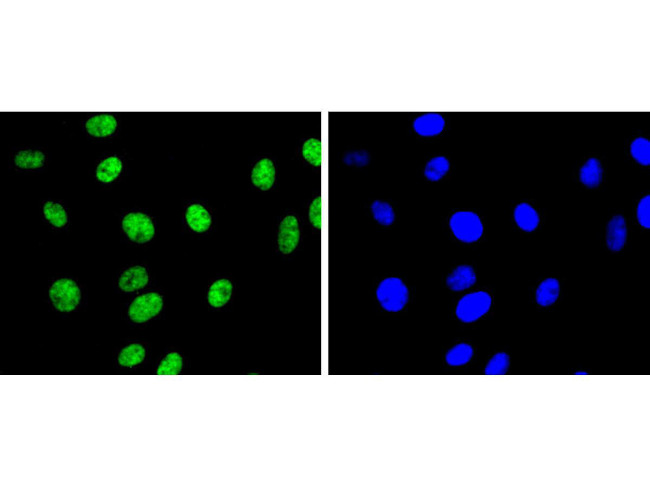 H3K9me2 Antibody in Immunocytochemistry (ICC/IF)