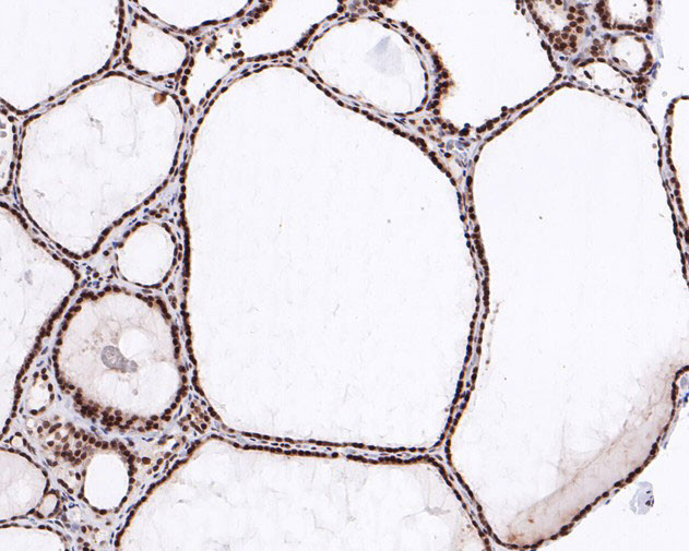 H3K9me2 Antibody in Immunohistochemistry (Paraffin) (IHC (P))