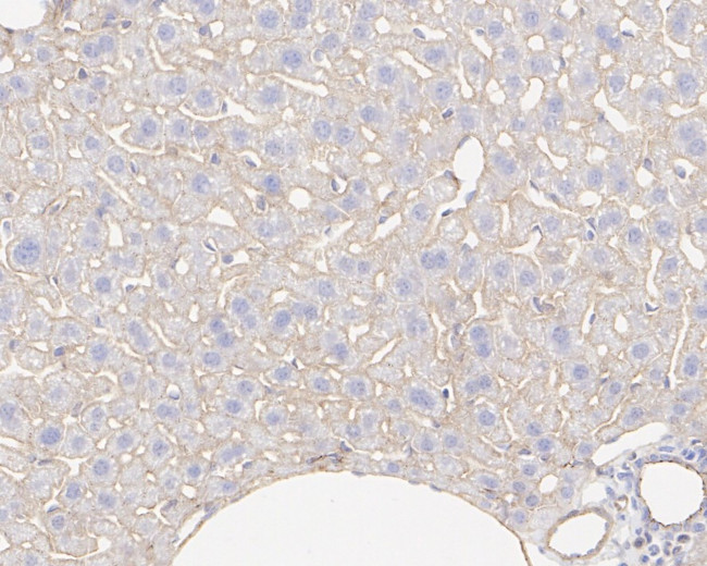 INSR beta Antibody in Immunohistochemistry (Paraffin) (IHC (P))