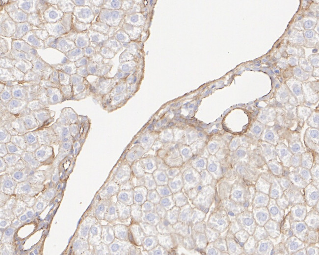 INSR beta Antibody in Immunohistochemistry (Paraffin) (IHC (P))