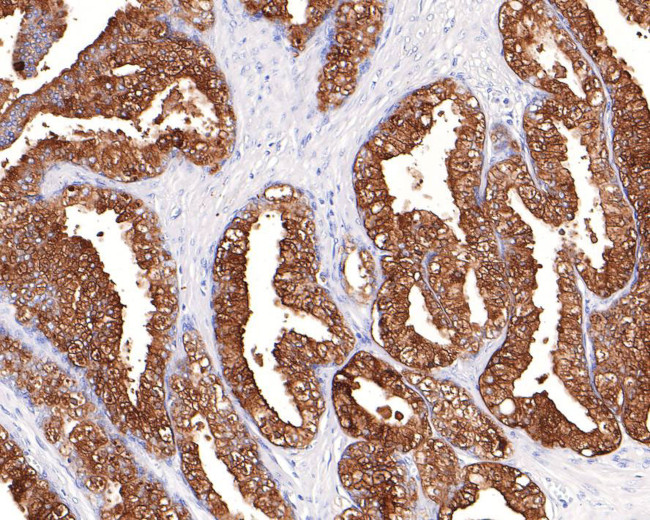 PSA Antibody in Immunohistochemistry (Paraffin) (IHC (P))