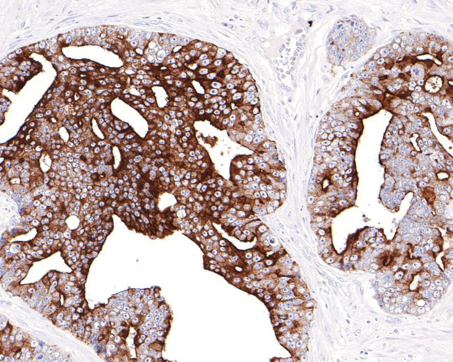 PSA Antibody in Immunohistochemistry (Paraffin) (IHC (P))