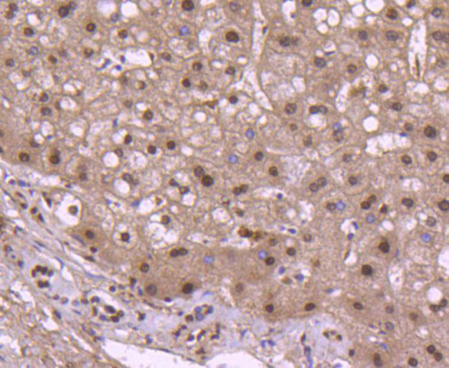 Histone H2B Antibody in Immunohistochemistry (Paraffin) (IHC (P))