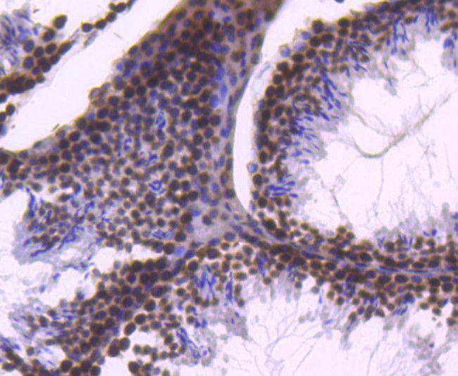 Histone H2B Antibody in Immunohistochemistry (Paraffin) (IHC (P))