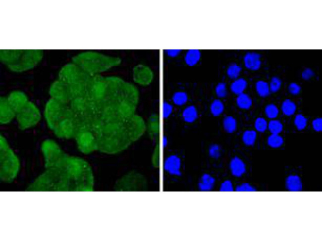 IRS1 Antibody in Immunocytochemistry (ICC/IF)