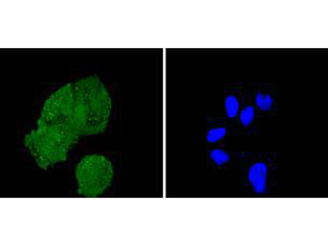 IRS1 Antibody in Immunocytochemistry (ICC/IF)