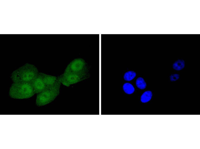 IRS1 Antibody in Immunocytochemistry (ICC/IF)