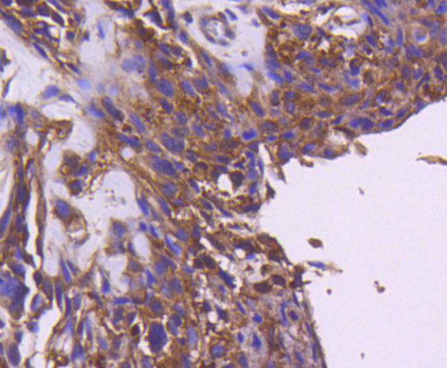 IRS1 Antibody in Immunohistochemistry (Paraffin) (IHC (P))